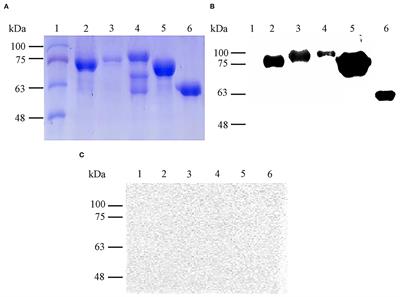 Immunization With a Combination of Four Recombinant Brucella abortus Proteins Omp16, Omp19, Omp28, and L7/L12 Induces T Helper 1 Immune Response Against Virulent B. abortus 544 Infection in BALB/c Mice